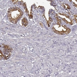 Semenogelin II Antibody, Novus Biologicals 25 &mu;L, Unconjugated:Antibodies,