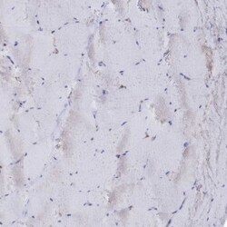 Semenogelin II Antibody, Novus Biologicals 25 &mu;L, Unconjugated:Antibodies,