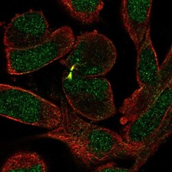 Senataxin Antibody, Novus Biologicals:Antibodies:Primary Antibodies