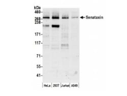 Senataxin Antibody, Novus Biologicals 0.1mg; Unlabeled:Anticorps, Polyclonal