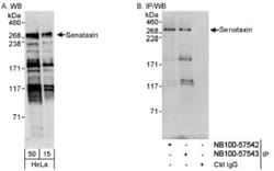 Senataxin Antibody, Novus Biologicals 100 &mu;L | Buy Online | Novus Biologicals | Fisher Scientific