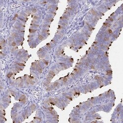Sentan Antibody, Novus Biologicals:Antibodies:Primary Antibodies