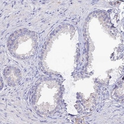Sentan Antibody, Novus Biologicals 25 &mu;L, Unlabeled:Antibodies, Polyclonal