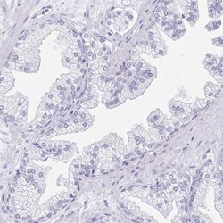 Sentan Antibody, Novus Biologicals:Antibodies:Primary Antibodies