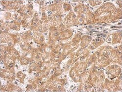 Septin-11 Antibody, Novus Biologicals 0.1mL; Unlabeled:Antibodies, Polyclonal