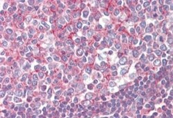 Septin-2 Antibody, Novus Biologicals 0.1mg; Unlabeled:Antibodies, Polyclonal