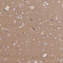 Septin-3 Antibody, Novus Biologicals 25 &mu;L; Unlabeled:Antibodies, Polyclonal