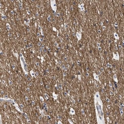 Septin-4 Antibody, Novus Biologicals 25 &mu;L; Unlabeled:Antibodies, Polyclonal