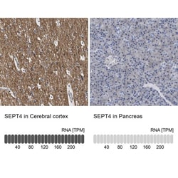 Septin-4 Antibody, Novus Biologicals 25 &mu;L; Unlabeled:Antibodies, Polyclonal