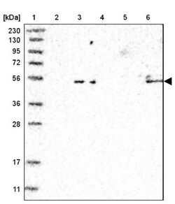 Septin-4 Antibody, Novus Biologicals 25 &mu;L; Unlabeled:Antibodies, Polyclonal