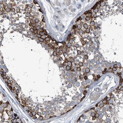 Septin-7 Antibody, Novus Biologicals 0.1mL; Unlabeled:Antibodies, Polyclonal