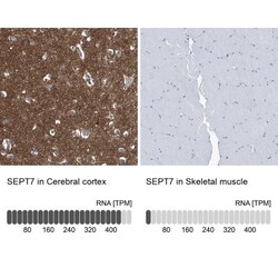 Septin-7 Antibody, Novus Biologicals 0.1mL; Unlabeled:Antibodies, Polyclonal