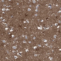 Septin-7 Antibody, Novus Biologicals 0.1mL; Unlabeled:Antibodies