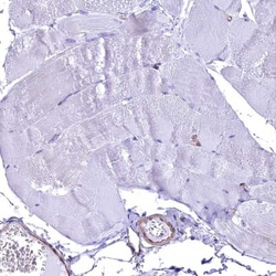 Septin-9 Antibody, Novus Biologicals 25 &mu;L, Unlabeled:Antibodies, Polyclonal