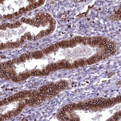 Septin-9 Antibody, Novus Biologicals 25 &mu;L, Unlabeled:Antibodies, Polyclonal