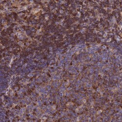 Septin-9 Antibody, Novus Biologicals 25 &mu;L, Unlabeled:Antibodies, Polyclonal