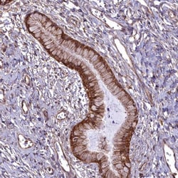 Septin-9 Antibody, Novus Biologicals 25 &mu;L, Unlabeled:Antibodies, Polyclonal