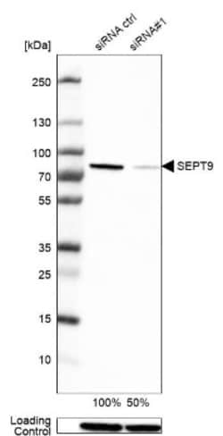 Septin-9 Antibody, Novus Biologicals 25 &mu;L, Unlabeled:Antibodies, Polyclonal