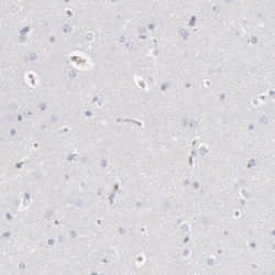 Serpin A1/alpha 1-Antitrypsin Antibody, Novus Biologicals:Antibodies:Primary