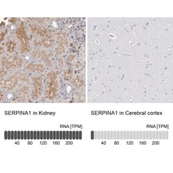 Serpin A1/alpha 1-Antitrypsin Antibody, Novus Biologicals:Antibodies:Primary
