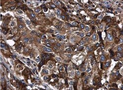 Serpin A1/alpha 1-Antitrypsin Antibody, Novus Biologicals 0.1mL; Unlabeled:Antibodies,