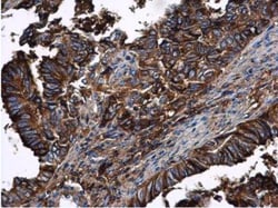 Serpin A1/alpha 1-Antitrypsin Antibody, Novus Biologicals 0.1mL; Unlabeled:Antibodies,
