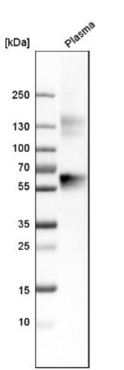 Serpin A1/alpha 1-Antitrypsin Antibody, Novus Biologicals:Antibodies:Primary