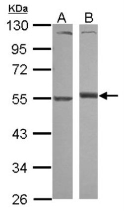 Serpin A1/alpha 1-Antitrypsin Antibody, Novus Biologicals 0.1mL; Unlabeled:Antibodies,