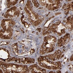 Serpin A3/alpha 1-Antichymotrypsin Antibody, Novus Biologicals 0.1mL; Unlabeled:Antibodies,