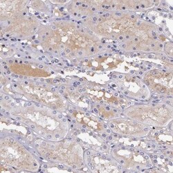 Serpin A3/alpha 1-Antichymotrypsin Antibody, Novus Biologicals 0.1mL; Unlabeled:Antibodies,