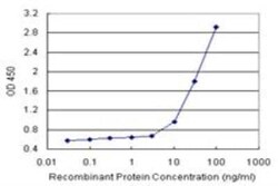 Novus Biologicals Serpin A3/alpha 1-Antichymotrypsin Antibody Pair 1 Set | Buy Online | Novus Biologicals&trade; | Fisher Scientific