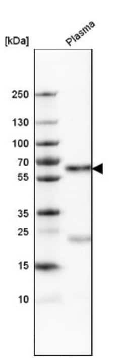 Serpin A3/alpha 1-Antichymotrypsin Antibody, Novus Biologicals 0.1mL; Unlabeled:Antibodies,