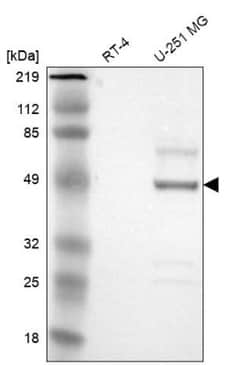 Serpin A3/alpha 1-Antichymotrypsin Antibody, Novus Biologicals 0.1mL; Unlabeled:Antibodies,