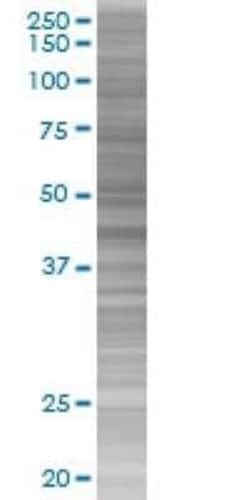 Novus Biologicals Serpin A3/alpha 1-Antichymotrypsin 293T Cell Transient Overexpression Lysate 0.1 mL | Buy Online | Novus Biologicals&trade; | Fisher Scientific