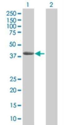 Novus Biologicals Serpin A3/alpha 1-Antichymotrypsin 293T Cell Transient Overexpression Lysate 0.1 mL | Buy Online | Novus Biologicals&trade; | Fisher Scientific