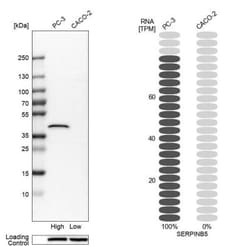 Serpin B5/Maspin Antibody, Novus Biologicals 0.1mL; Unlabeled:Antibodies,
