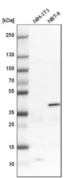 Serpin B5/Maspin Antibody, Novus Biologicals 0.1mL; Unlabeled:Antibodies,
