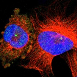 5'-Nucleotidase/CD73 Antibody, Novus Biologicals:Antibodies:Primary Antibodies