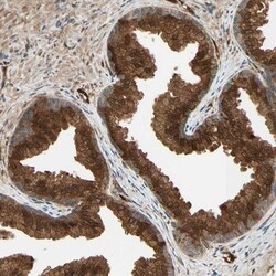 5'-Nucleotidase/CD73 Antibody, Novus Biologicals:Antibodies:Primary Antibodies