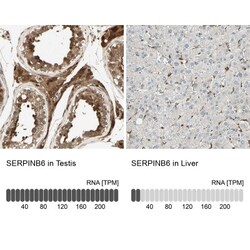 5'-Nucleotidase/CD73 Antibody, Novus Biologicals:Antibodies:Primary Antibodies
