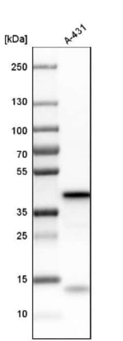 5'-Nucleotidase/CD73 Antibody, Novus Biologicals:Antibodies:Primary Antibodies