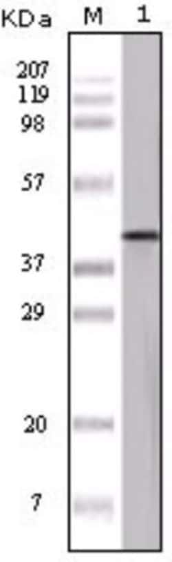 Serpin B8/Proteinase Inhibitor 8 Antibody (3G2E1D9) - BSA Free, Novus Biologicals:Antibodies:Primary