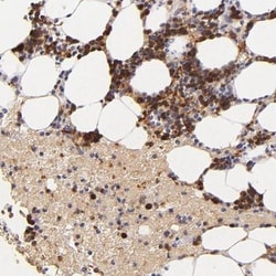 Serpin C1/Antithrombin-III Antibody, Novus Biologicals 25 &mu;L; Unlabeled:Antibodies,