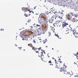 Serpin D1/Heparin Cofactor II Antibody, Novus Biologicals:Antibodies:Primary