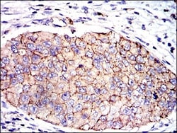 Serpin E1/PAI-1 Antibody (1D5) - BSA Free, Novus Biologicals:Antibodies:Primary
