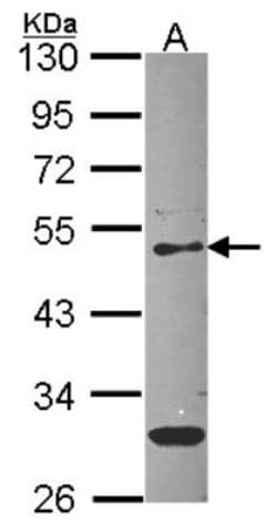 Serpin F1/PEDF Antibody, Novus Biologicals 0.1mL; Unlabeled:Antibodies,