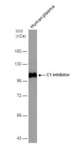 Serpin G1/C1 Inhibitor Antibody, Novus Biologicals 0.1mg; Unlabeled:Antibodies,