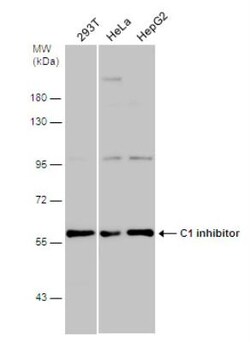 Serpin G1/C1 Inhibitor Antibody, Novus Biologicals 0.1mg; Unlabeled:Antibodies,
