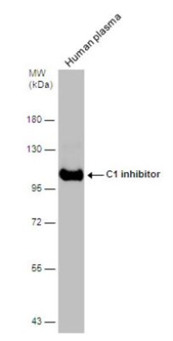 Serpin G1/C1 Inhibitor Antibody, Novus Biologicals 0.1mL; Unlabeled:Antibodies,