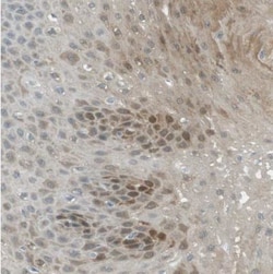 SerpinB2 Antibody, Novus Biologicals 0.1mL; Unlabeled:Antibodies, Polyclonal